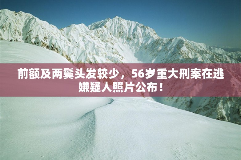 前额及两鬓头发较少，56岁重大刑案在逃嫌疑人照片公布！